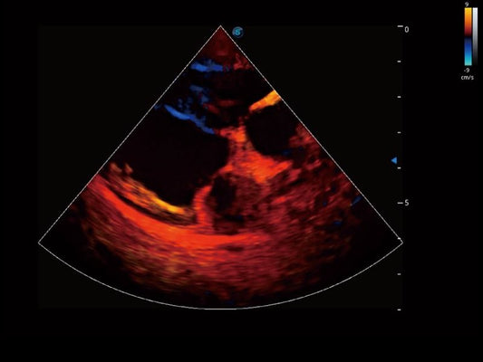 Sonoscape ProPet60 professzionális ultrahang készülék