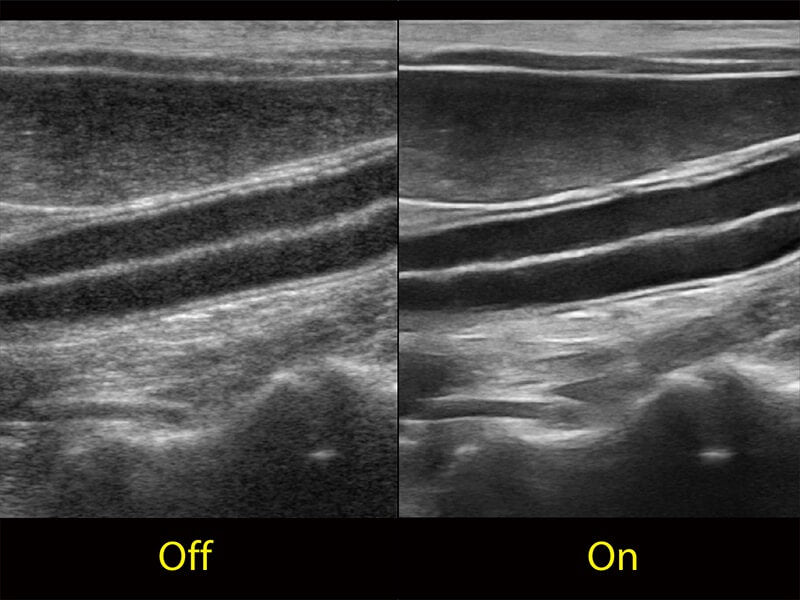 Sonoscape ProPet60 professzionális ultrahang készülék
