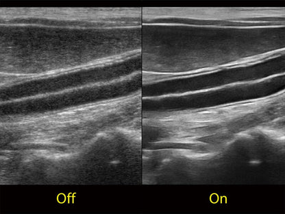 Sonoscape ProPet60 professzionális ultrahang készülék