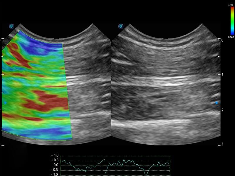 Sonoscape ProPet60 professzionális ultrahang készülék
