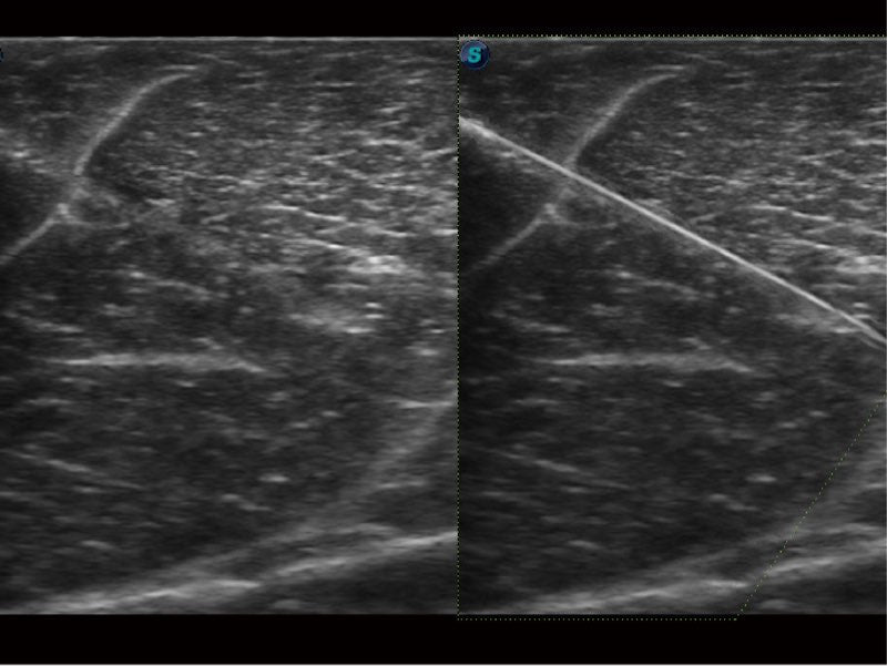 Sonoscape ProPet60 professzionális ultrahang készülék