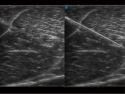 Sonoscape ProPet60 professzionális ultrahang készülék
