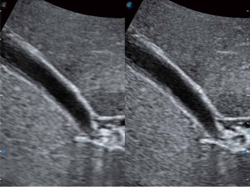 Sonoscape ProPet60 professzionális ultrahang készülék