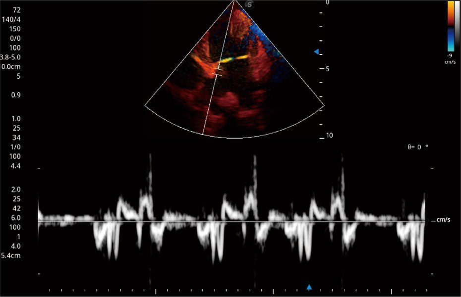 Sonoscape ProPet60 professzionális ultrahang készülék