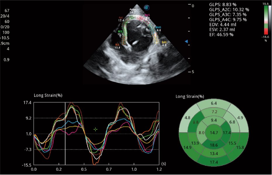 Sonoscape ProPet60 professzionális ultrahang készülék