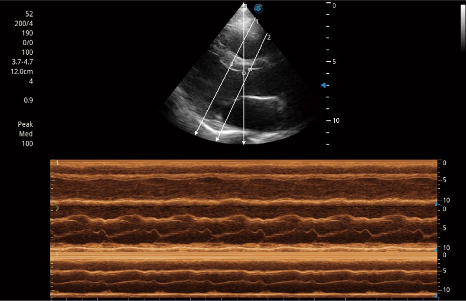 Sonoscape ProPet60 professzionális ultrahang készülék