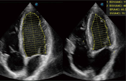 Sonoscape ProPet60 professzionális ultrahang készülék