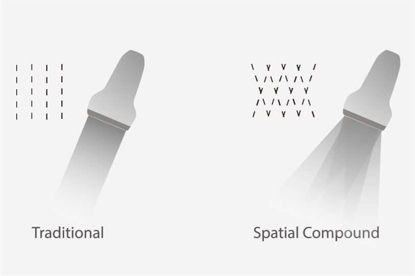 SonoScape ProPet 70 színes dopler ultrahang