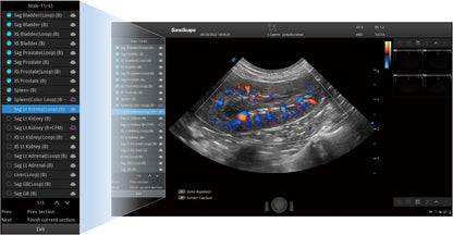 Sonoscape ProPet60 professzionális ultrahang készülék