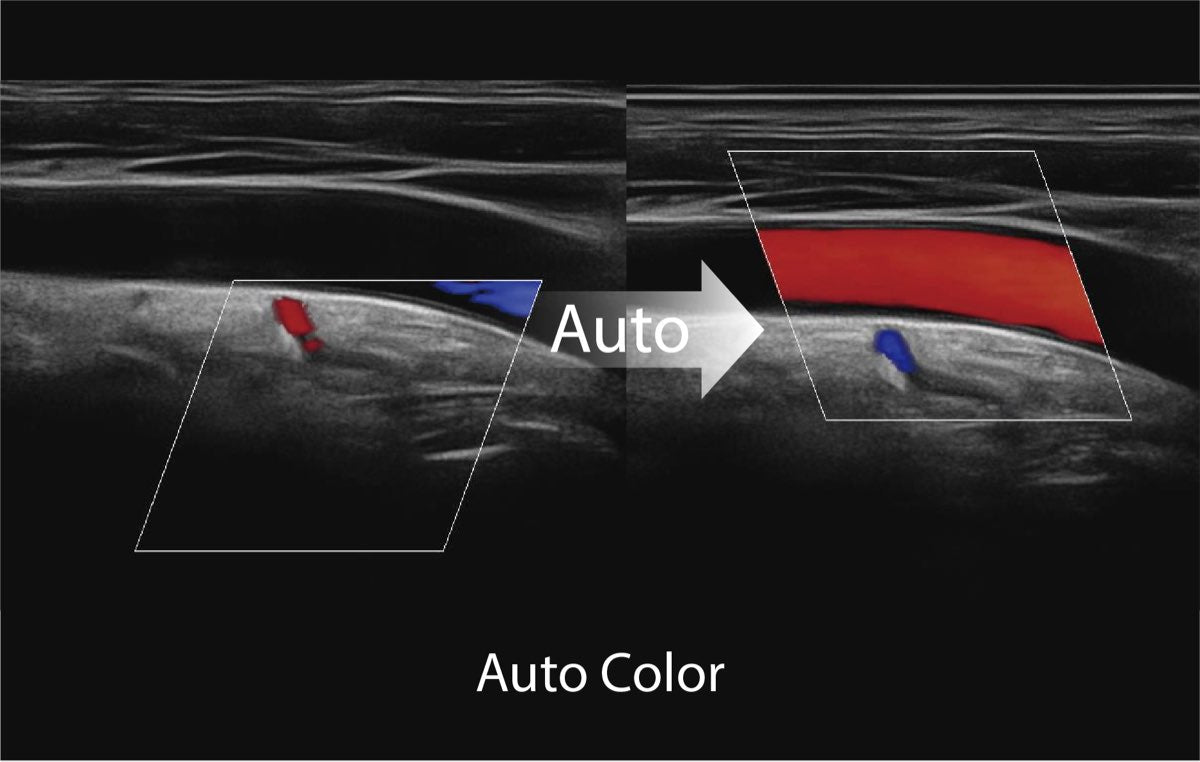 Sonoscape ProPet60 professzionális ultrahang készülék