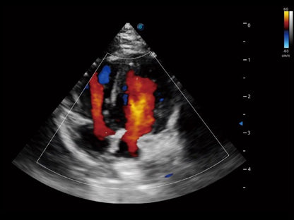 Sonoscape ProPet60 professzionális ultrahang készülék