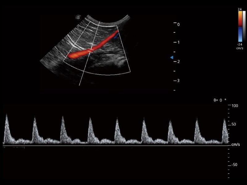 Sonoscape ProPet60 professzionális ultrahang készülék
