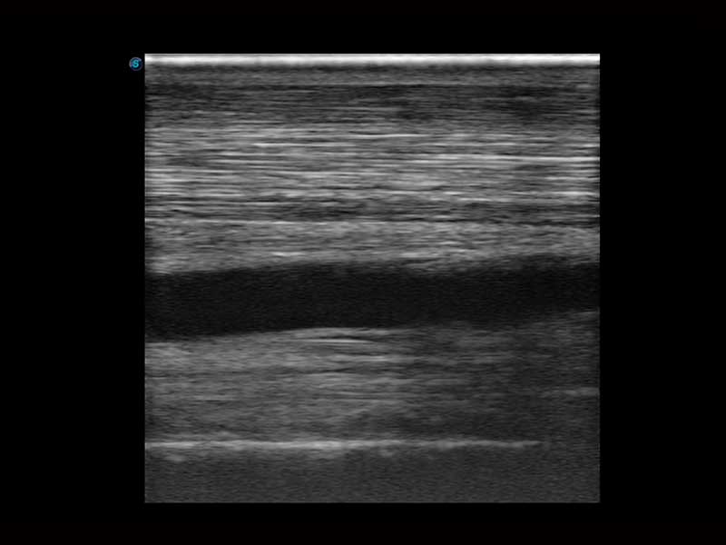 Sonoscape X5V színes, hordozható, Doppler ultrahang lóspecifikus szoftverrel