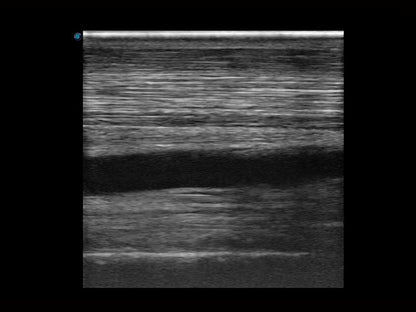 Sonoscape X5V színes, hordozható, Doppler ultrahang lóspecifikus szoftverrel
