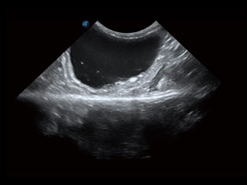 Sonoscape ProPet60 professzionális ultrahang készülék