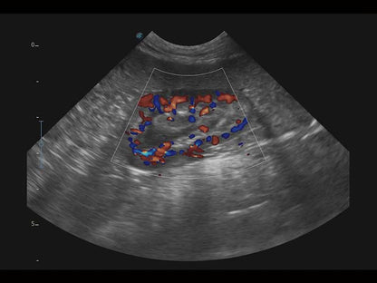 Sonoscape X5V színes, hordozható, Doppler ultrahang lóspecifikus szoftverrel