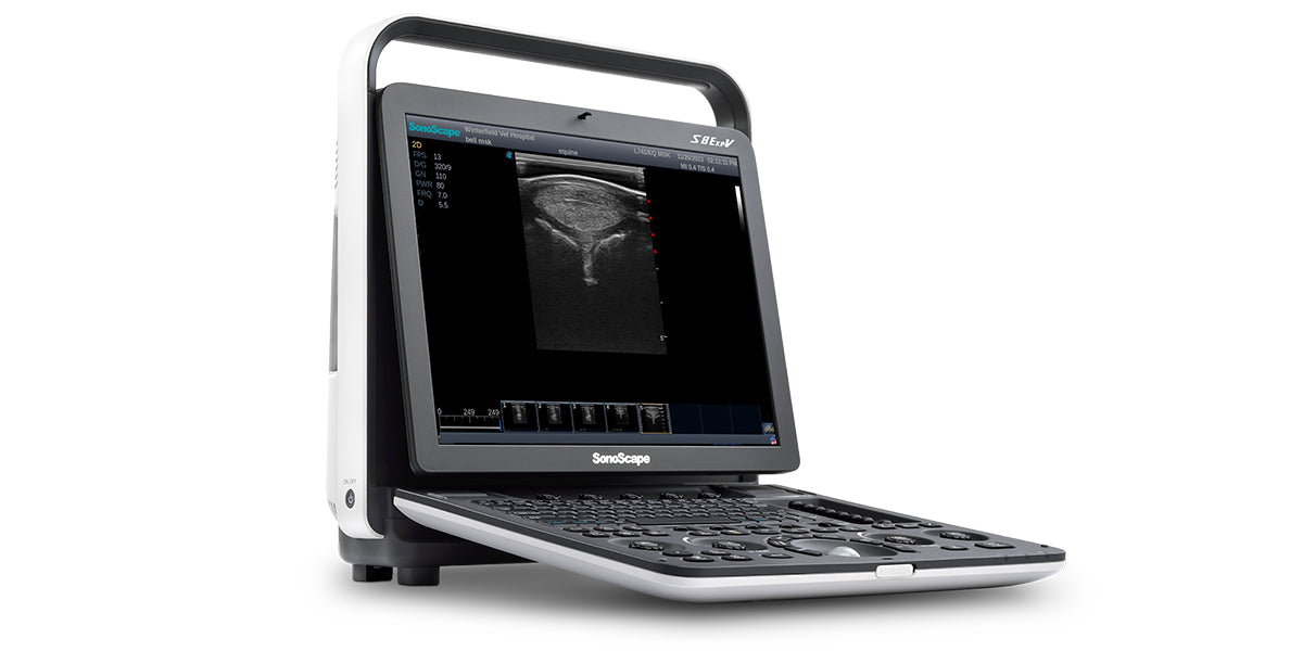 Sonoscape S8 expV hordozható ultrahang készülék