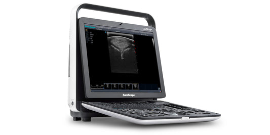 Sonoscape S8 expV hordozható ultrahang készülék