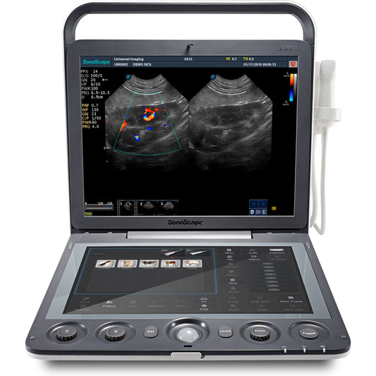 Sonoscape S9V hordozható, színes Doppler ultrahang készülék